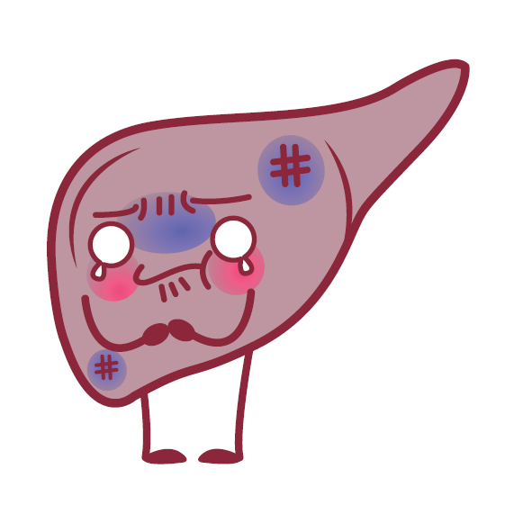 What Is Liver Steatosis Or Fatty Liver Disease Causes